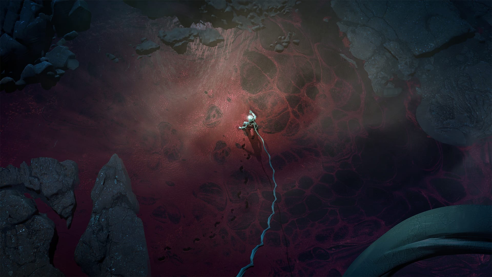 umbilical