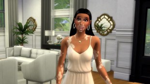 Sims 4 vitiligo update